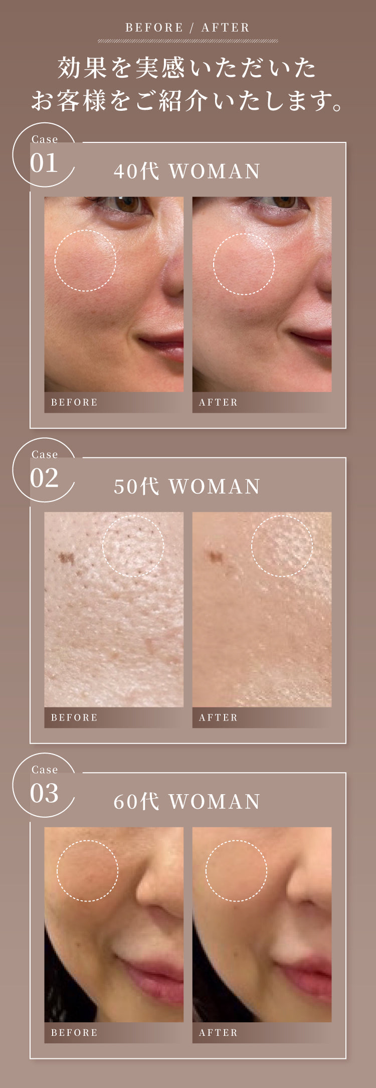 公式】UMBILICAL（アンビリカル）プレミアム エイジングケア セット